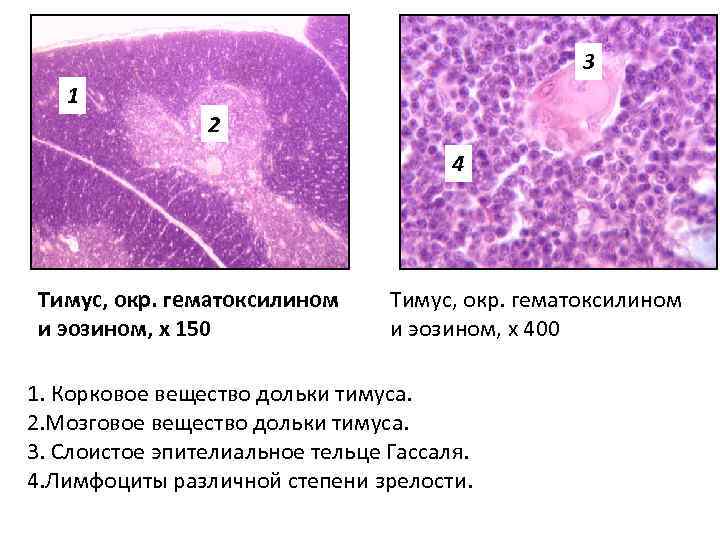 3 1 2 ЛИМФАТИЧЕСКИЙ УЗЕЛ СЕЛЕЗЕНКА 4 Тимус, окр. гематоксилином и эозином, х 150