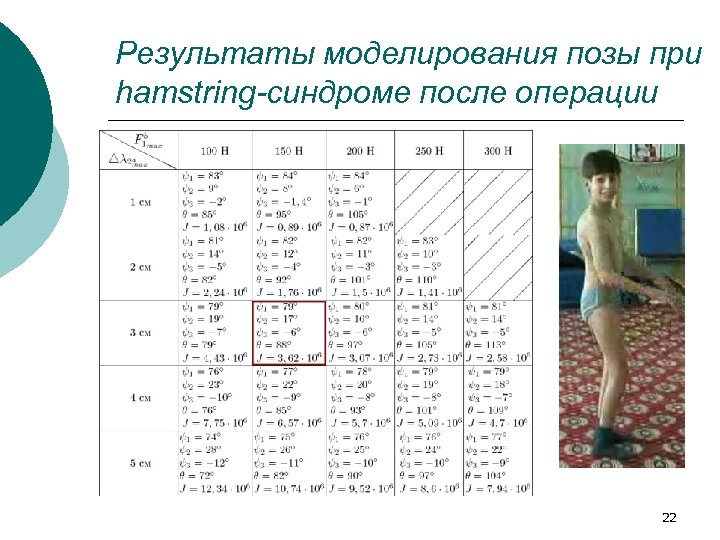 Результаты моделирования позы при hamstring-синдроме после операции 22 