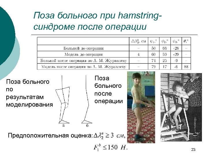 Поза больного при hamstringсиндроме после операции Поза больного по результатам моделирования Поза больного после