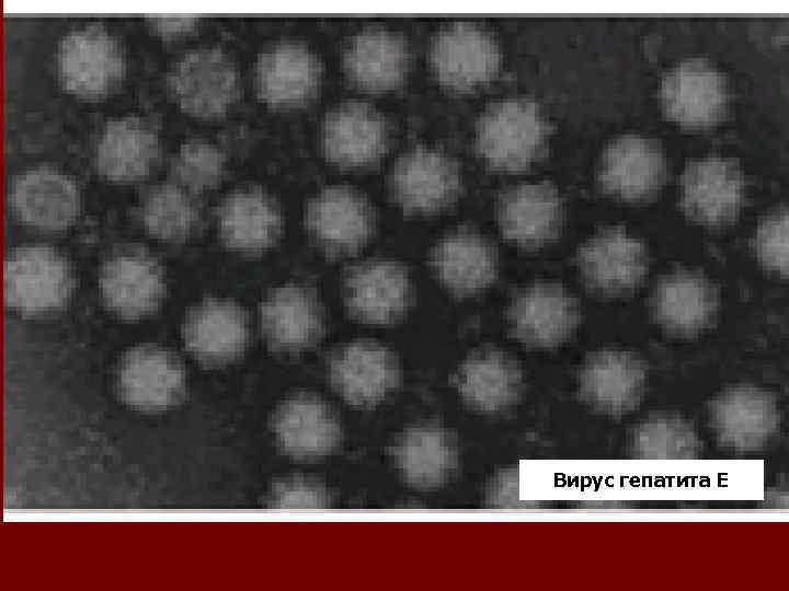 Вирус гепатита Е 