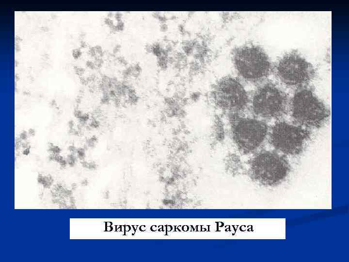 Вирус саркомы Рауса 