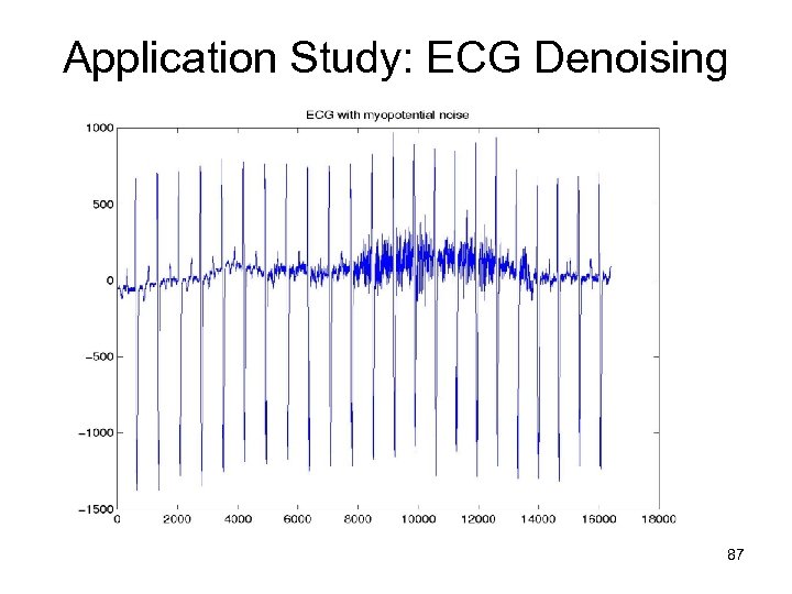 Application Study: ECG Denoising 87 