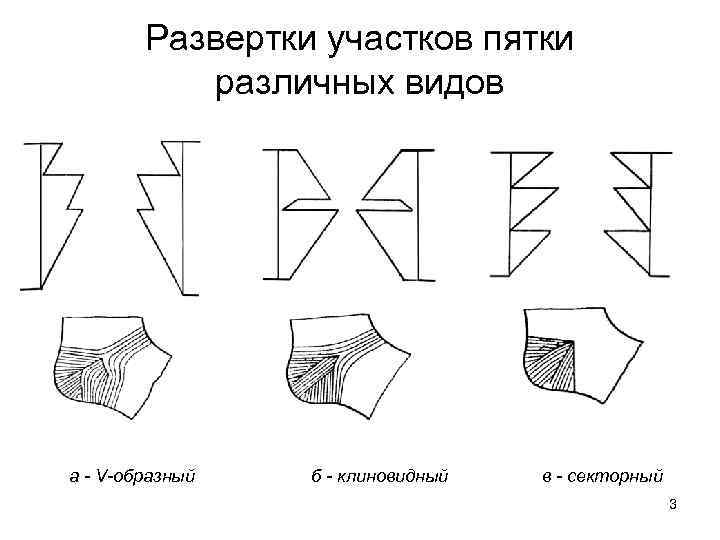 Развертки участков пятки различных видов а - V-образный б - клиновидный в - секторный