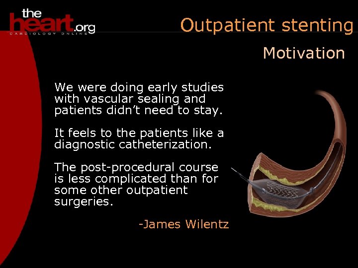 Outpatient stenting Motivation We were doing early studies with vascular sealing and patients didn’t