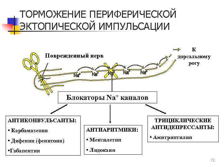 ТОРМОЖЕНИЕ ПЕРИФЕРИЧЕСКОЙ ЭКТОПИЧЕСКОЙ ИМПУЛЬСАЦИИ Поврежденный нерв К дорсальному рогу Блокаторы Na+ каналов АНТИКОНВУЛЬСАНТЫ: •