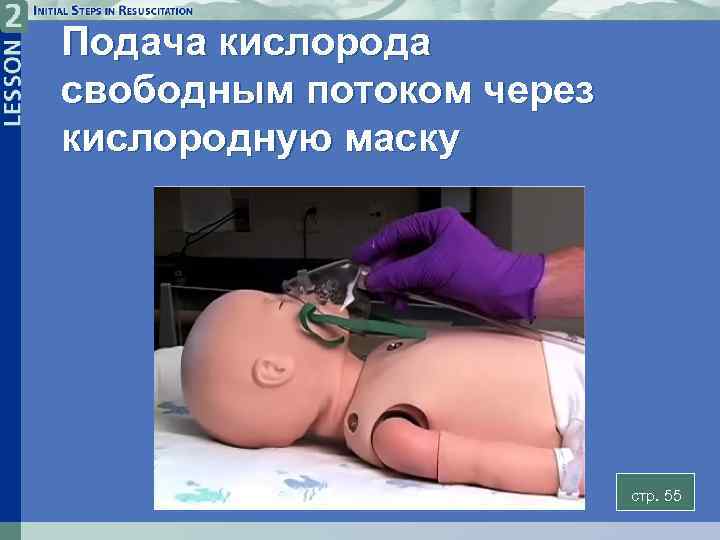 Подача кислорода свободным потоком через кислородную маску стр. 55 2 -19 C 