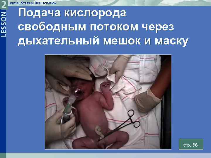 Подача кислорода свободным потоком через дыхательный мешок и маску стр. 56 2 -19 A