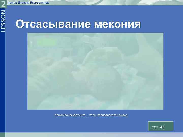 Отсасывание мекония Кликните на картинке, чтобы воспроизвести видео стp. 43 