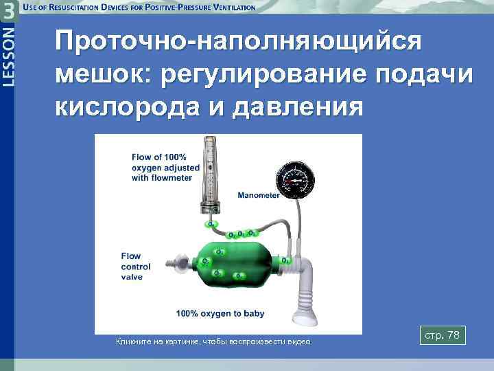 Проточно-наполняющийся мешок: регулирование подачи кислорода и давления давлени Кликните на картинке, чтобы воспроизвести видео