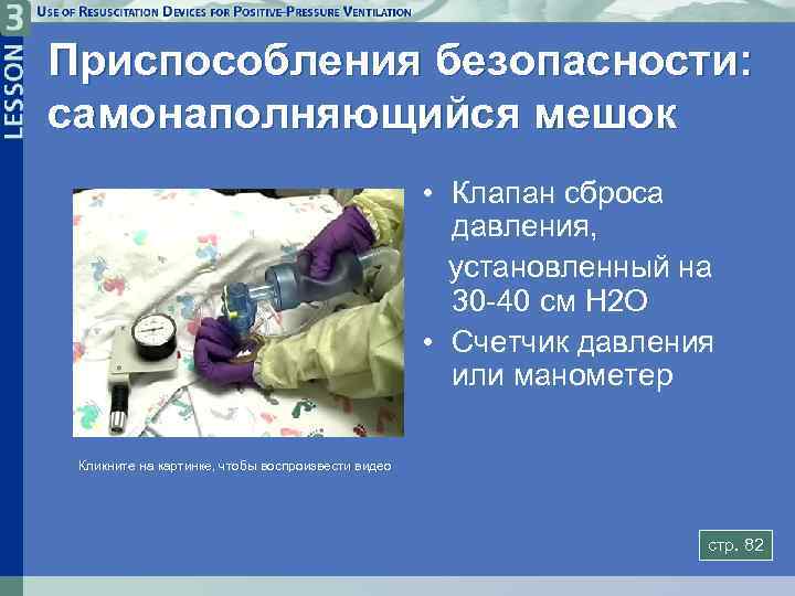 Приспособления безопасности: самонаполняющийся мешок • Клапан сброса давления, установленный на 30 -40 см H