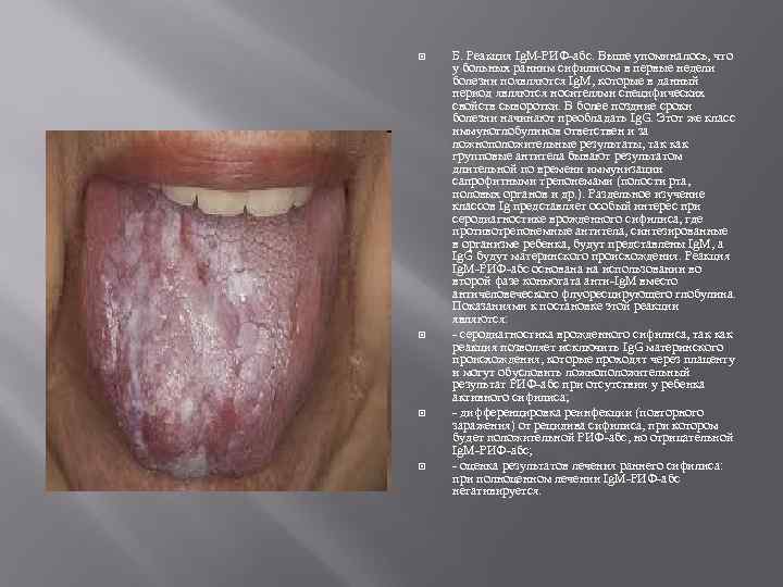  Б. Реакция Ig. M-РИФ-абс. Выше упоминалось, что у больных ранним сифилисом в первые