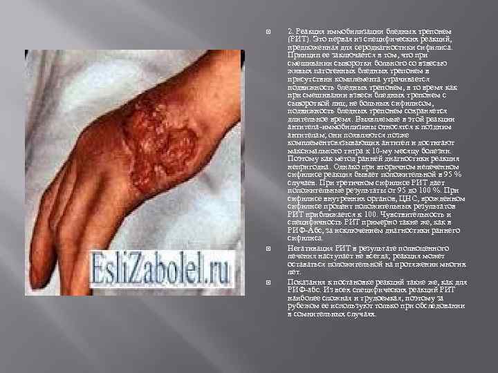  2. Реакция иммобилизации бледных трепонем (РИТ). Это первая из специфических реакций, предложенная для