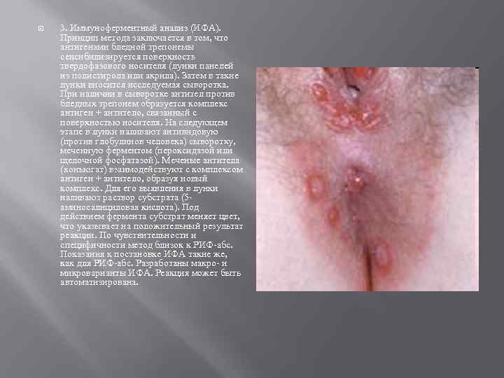  3. Иммуноферментный анализ (ИФА). Принцип метода заключается в том, что антигенами бледной трепонемы