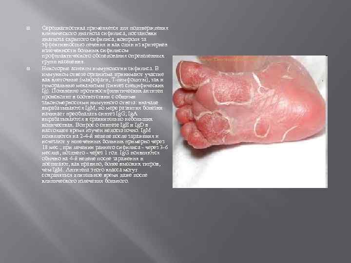  Серодиагностика применяется для подтверждения клинического диагноза сифилиса, постановки диагноза скрытого сифилиса, контроля за