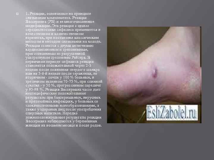  1. Реакции, основанные на принципе связывания комплемента. Реакция Вассермана (РВ) и ее многочисленные