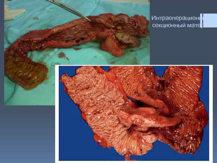 Интраоперационный и секционный материал 