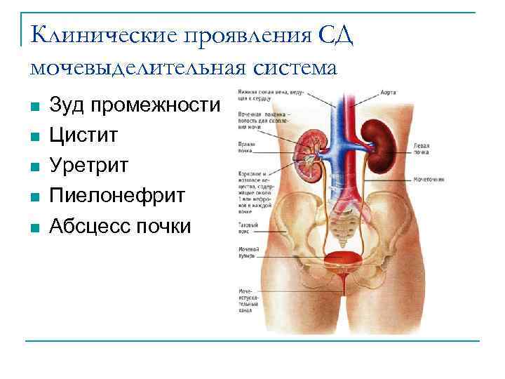 Клинические проявления СД мочевыделительная система n n n Зуд промежности Цистит Уретрит Пиелонефрит Абсцесс