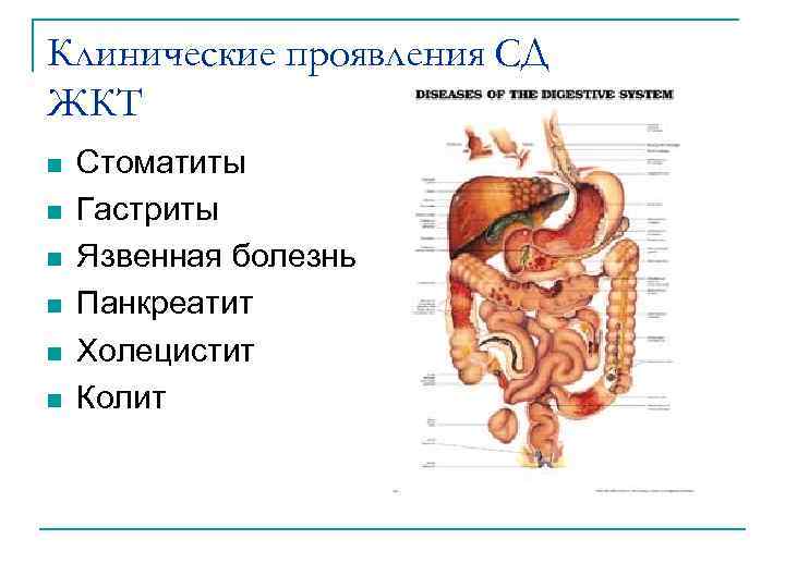 Клинические проявления СД ЖКТ n n n Стоматиты Гастриты Язвенная болезнь Панкреатит Холецистит Колит