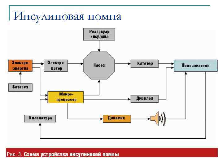 Инсулиновая помпа 