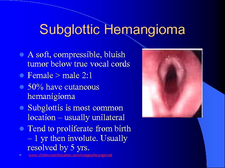 Subglottic Hemangioma l l l A soft, compressible, bluish tumor below true vocal cords