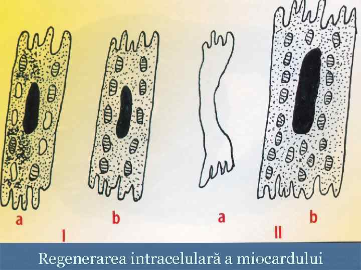 Regenerarea intracelulară a miocardului 