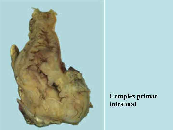 Complex primar intestinal 