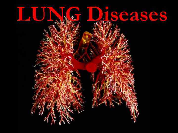 LUNG Diseases 