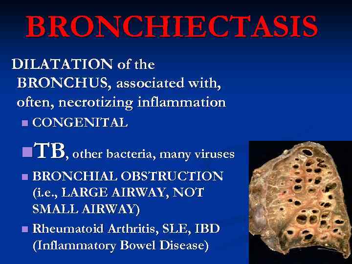 BRONCHIECTASIS DILATATION of the BRONCHUS, associated with, often, necrotizing inflammation n CONGENITAL n. TB,