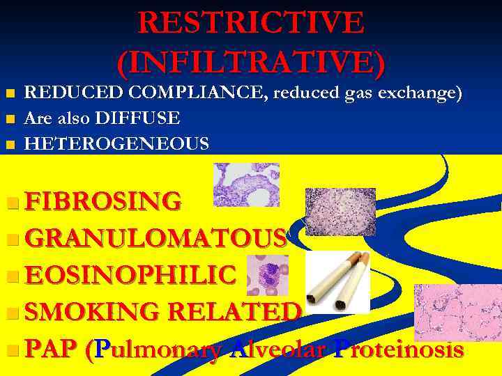 RESTRICTIVE (INFILTRATIVE) n n n REDUCED COMPLIANCE, reduced gas exchange) Are also DIFFUSE HETEROGENEOUS