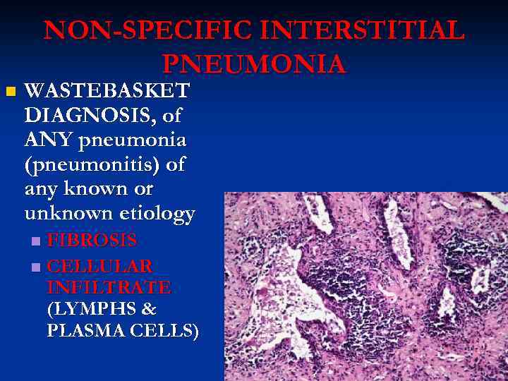 NON-SPECIFIC INTERSTITIAL PNEUMONIA n WASTEBASKET DIAGNOSIS, of ANY pneumonia (pneumonitis) of any known or