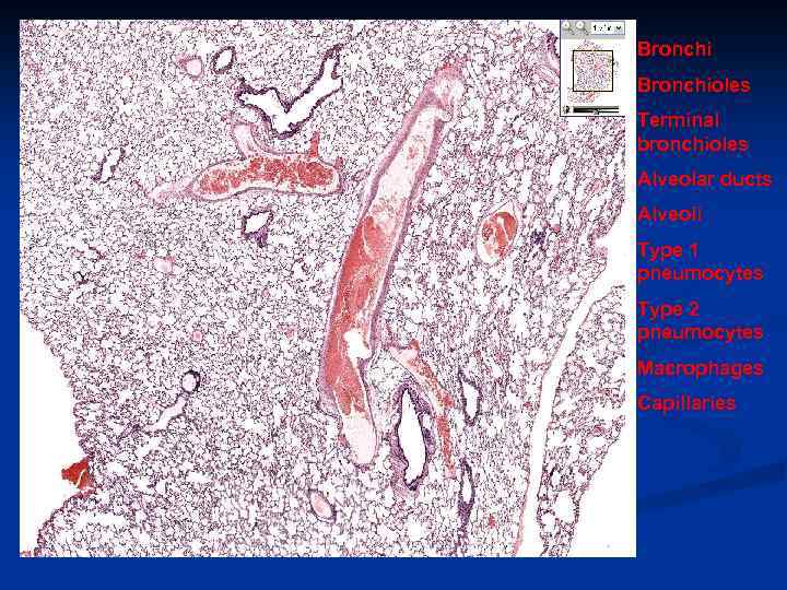 Bronchioles Terminal bronchioles Alveolar ducts Alveoli Type 1 pneumocytes Type 2 pneumocytes Macrophages Capillaries