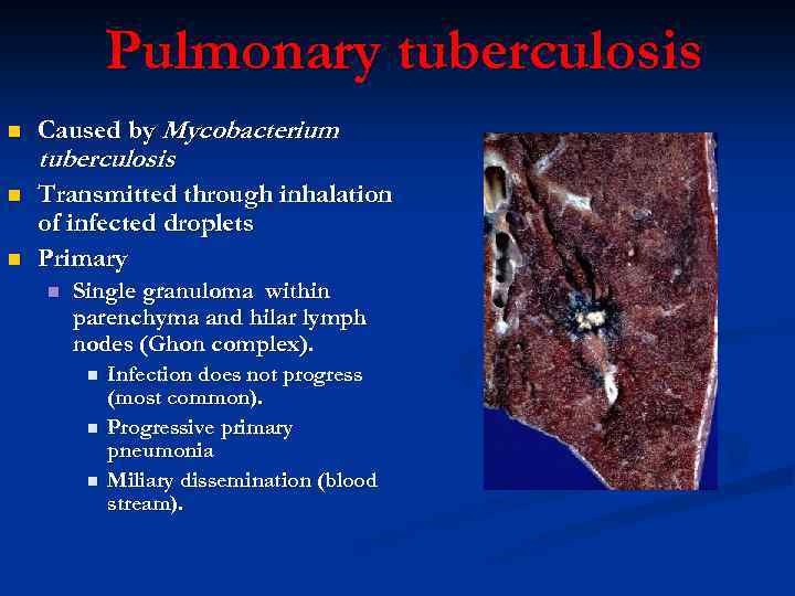 Pulmonary tuberculosis n n n Caused by Mycobacterium tuberculosis. Transmitted through inhalation of infected