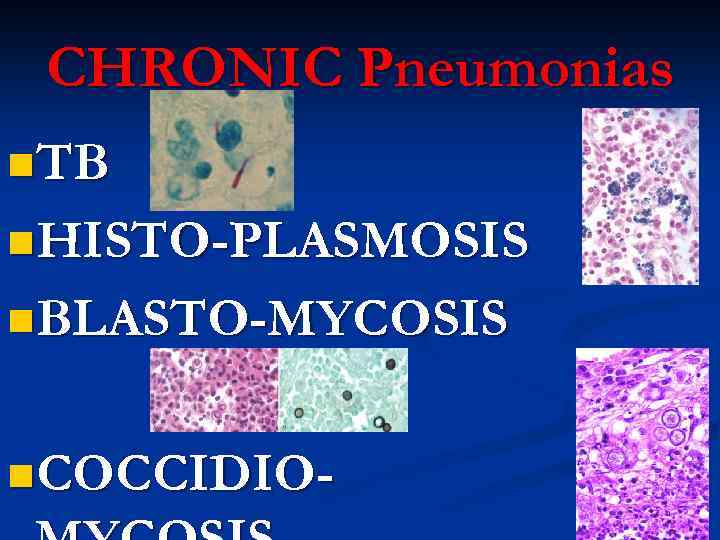 CHRONIC Pneumonias n. TB n. HISTO-PLASMOSIS n. BLASTO-MYCOSIS n. COCCIDIO- 