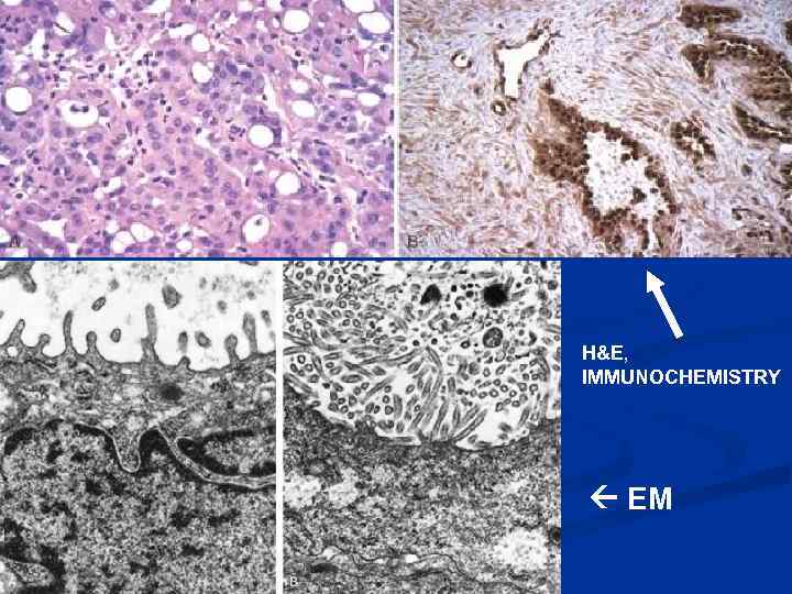 H&E, IMMUNOCHEMISTRY EM 