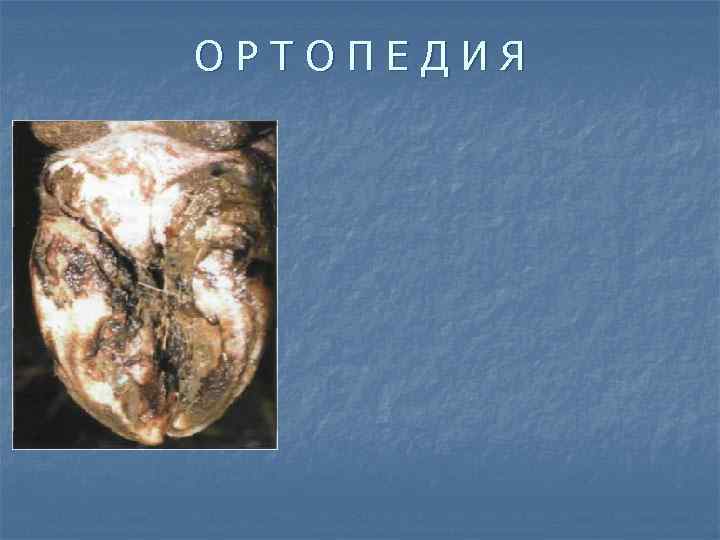 ОРТОПЕДИЯ 