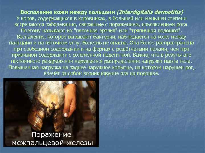 Воспаление кожи между пальцами (Interdigitalis dermatitis) У коров, содержащихся в коровниках, в большей или