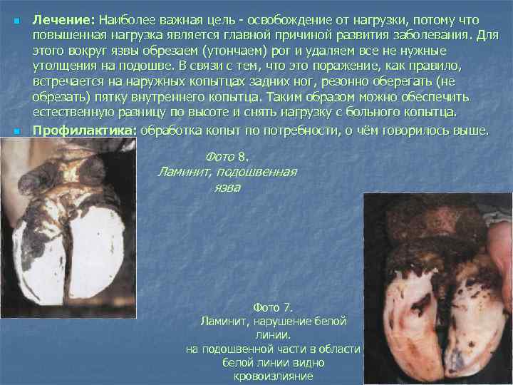 n n Лечение: Наиболее важная цель освобождение от нагрузки, потому что повышенная нагрузка является