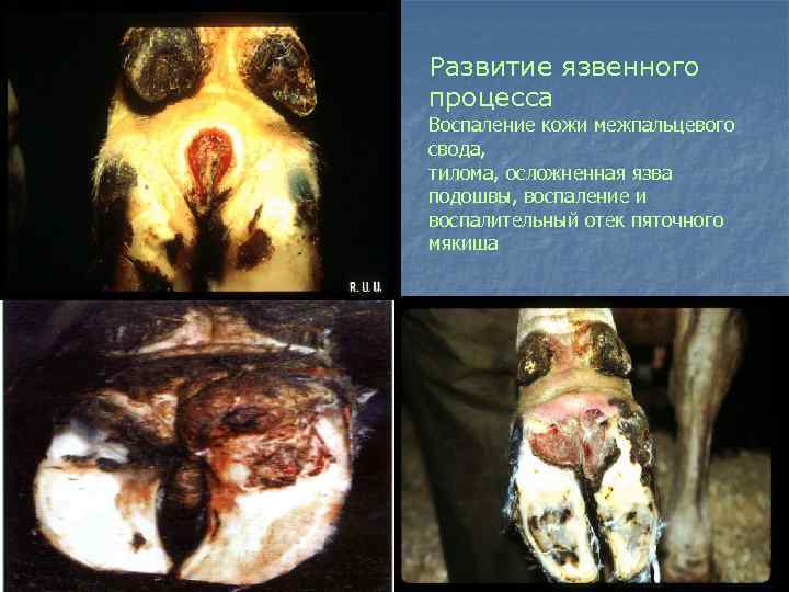 Развитие язвенного процесса Воспаление кожи межпальцевого свода, тилома, осложненная язва подошвы, воспаление и воспалительный