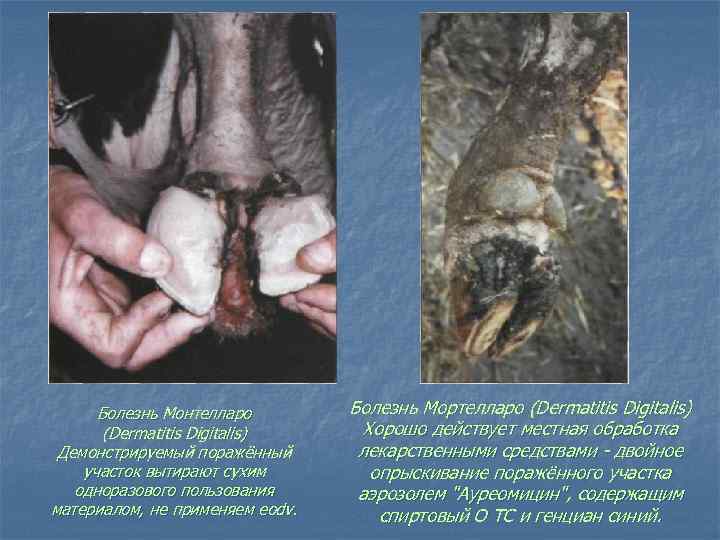 Болезнь Монтелларо (Dermatitis Digitalis) Демонстрируемый поражённый участок вытирают сухим одноразового пользования материалом, не применяем