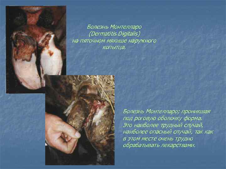Болезнь Монтелларо (Dermatitis Digitalis) на пяточном мякише наружного копытца. Болезнь Монтелларо; проникшая под роговую