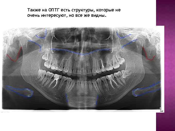 Также на ОПТГ есть структуры, которые не очень интересуют, но все же видны. 