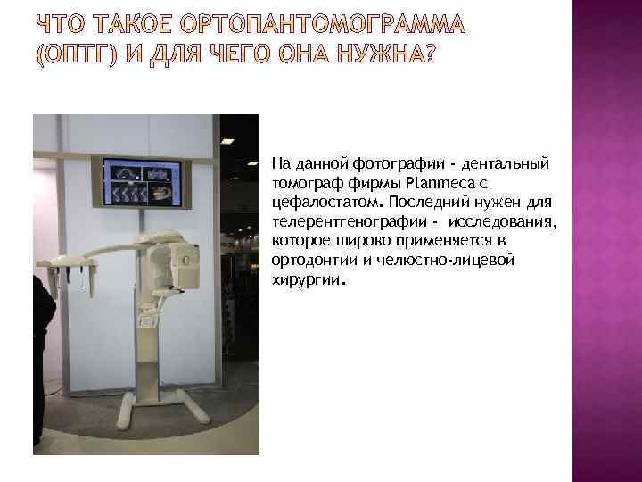 На данной фотографии - дентальный томограф фирмы Planmeca с цефалостатом. Последний нужен для телерентгенографии