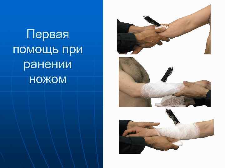 Первая помощь при ранении ножом 