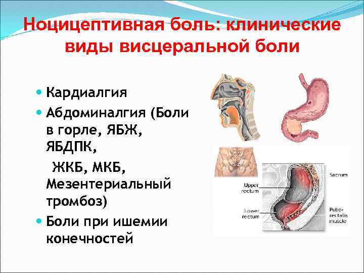 Ноцицептивная боль: клинические виды висцеральной боли Кардиалгия Абдоминалгия (Боли в горле, ЯБЖ, ЯБДПК, ЖКБ,