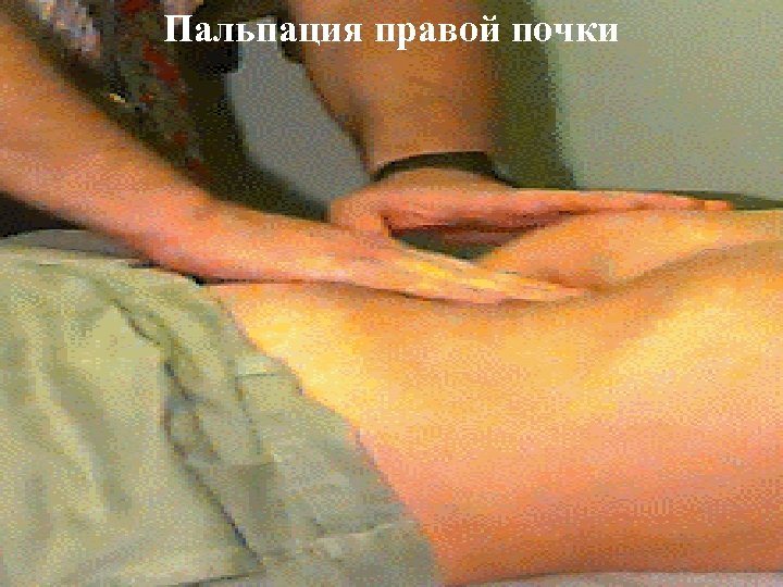 Пальпация правой почки 