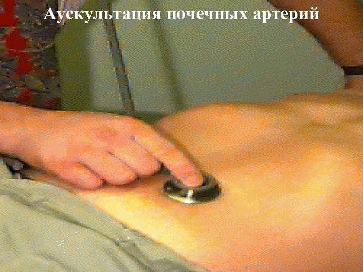 Аускультация почечных артерий 