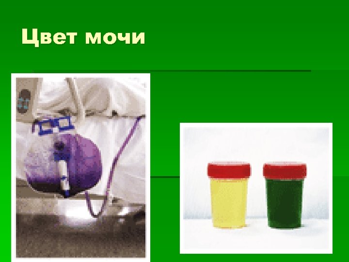 Цвет мочи 