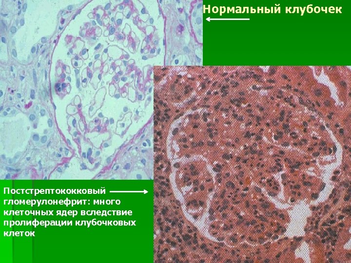 Седьмой стол при заболеваниях почек