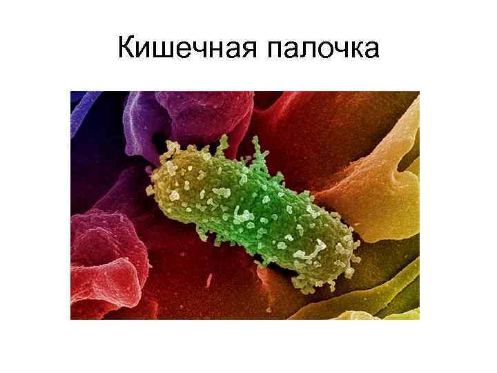 Кишечная палочка 