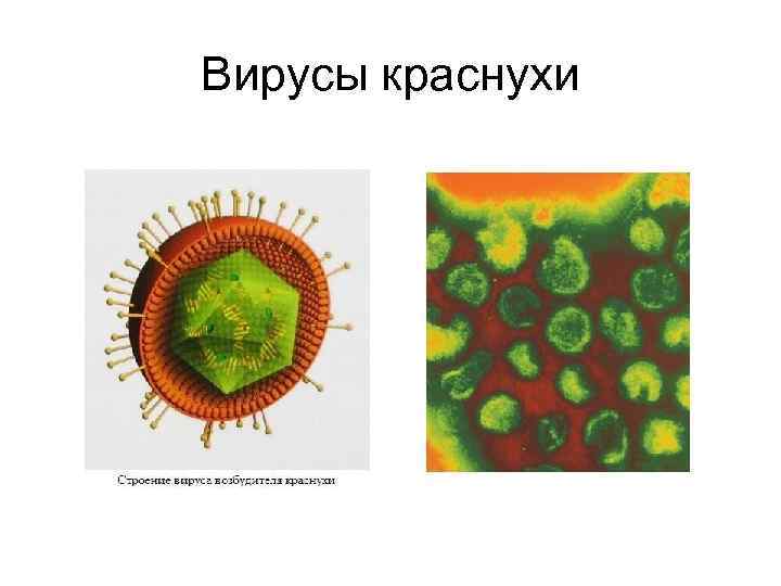 Вирусы краснухи 